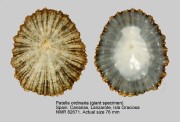 Patella ordinaria